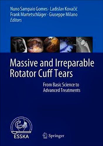 Portada del libro 9783662611616 Massive and Irreparable Rotator Cuff Tears. From Basic Science to Advanced Treatments