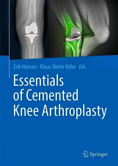 Portada del libro 9783662631126 Essentials of Cemented Knee Arthroplasty