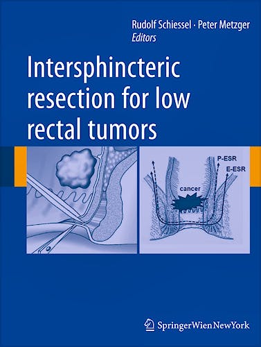 Portada del libro 9783709109281 Intersphincteric Resection for Low Rectal Tumors