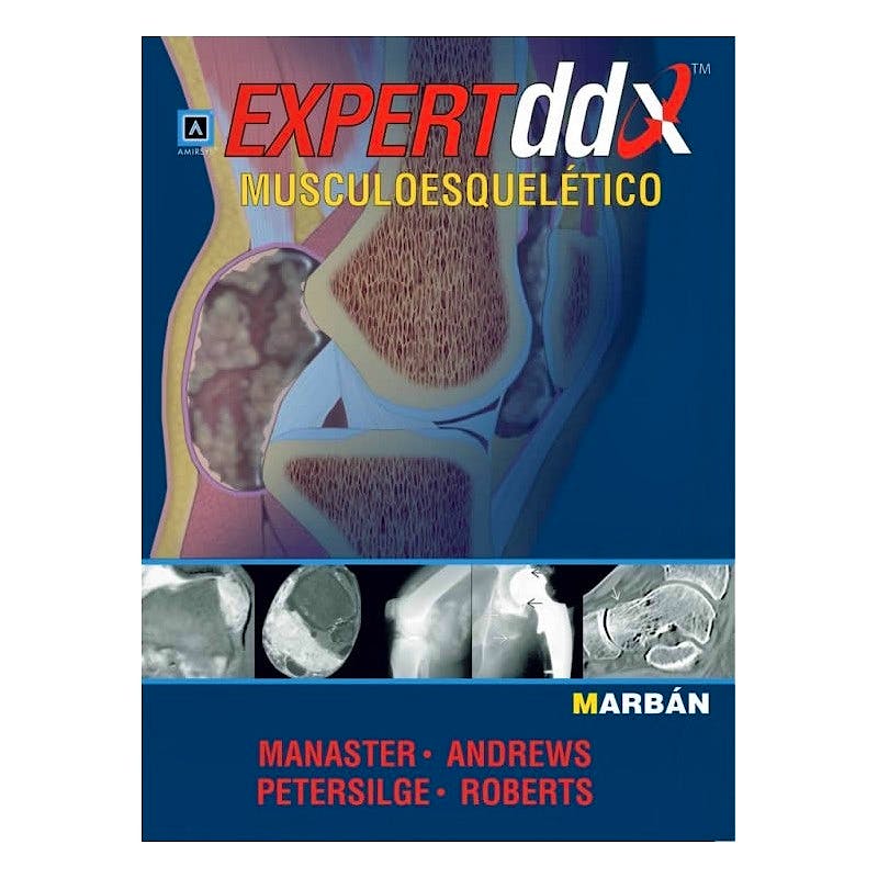 Portada del libro 9783742301901 Pack Diagnóstico por Imagen Musculoesquelético 2 Enfermedades no Traumáticas + Expert DDX Musculoesquelético
