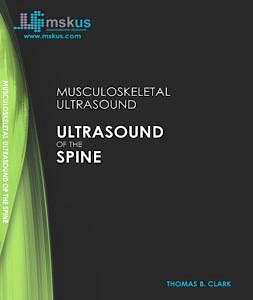 Portada del libro 9783785575789 (MSKUS) Musculoskeletal Ultrasound. Ultrasound Of The Spine