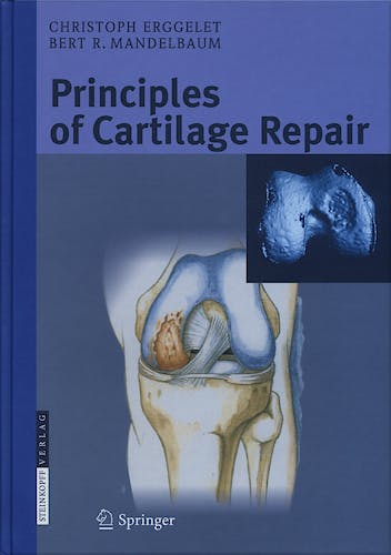 Portada del libro 9783798515901 Principles of Cartilage Repair