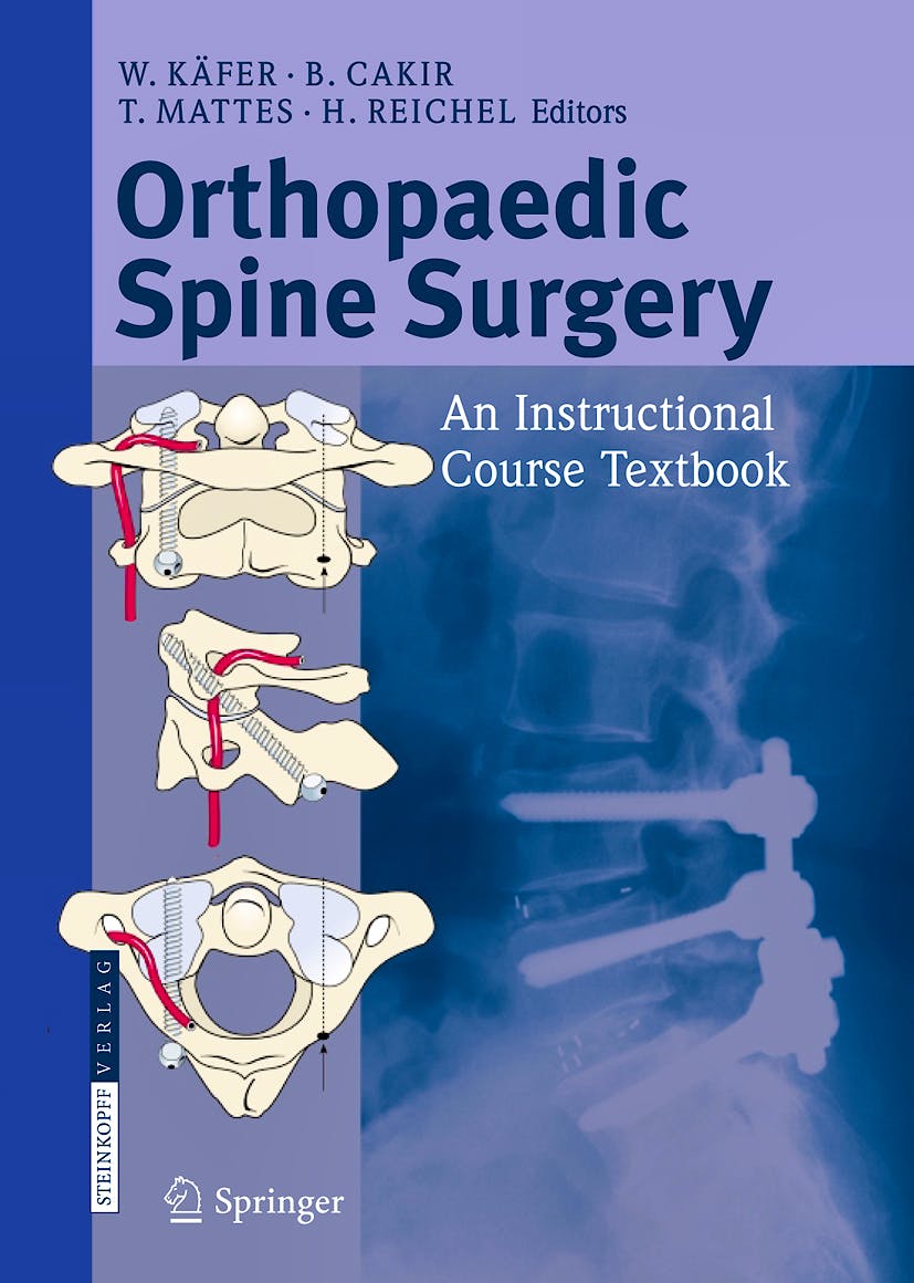 Portada del libro 9783798518285 Orthopaedic Spine Surgery