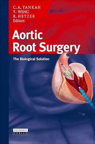 Portada del libro 9783798518681 Aortic Root Surgery. the Biological Solution