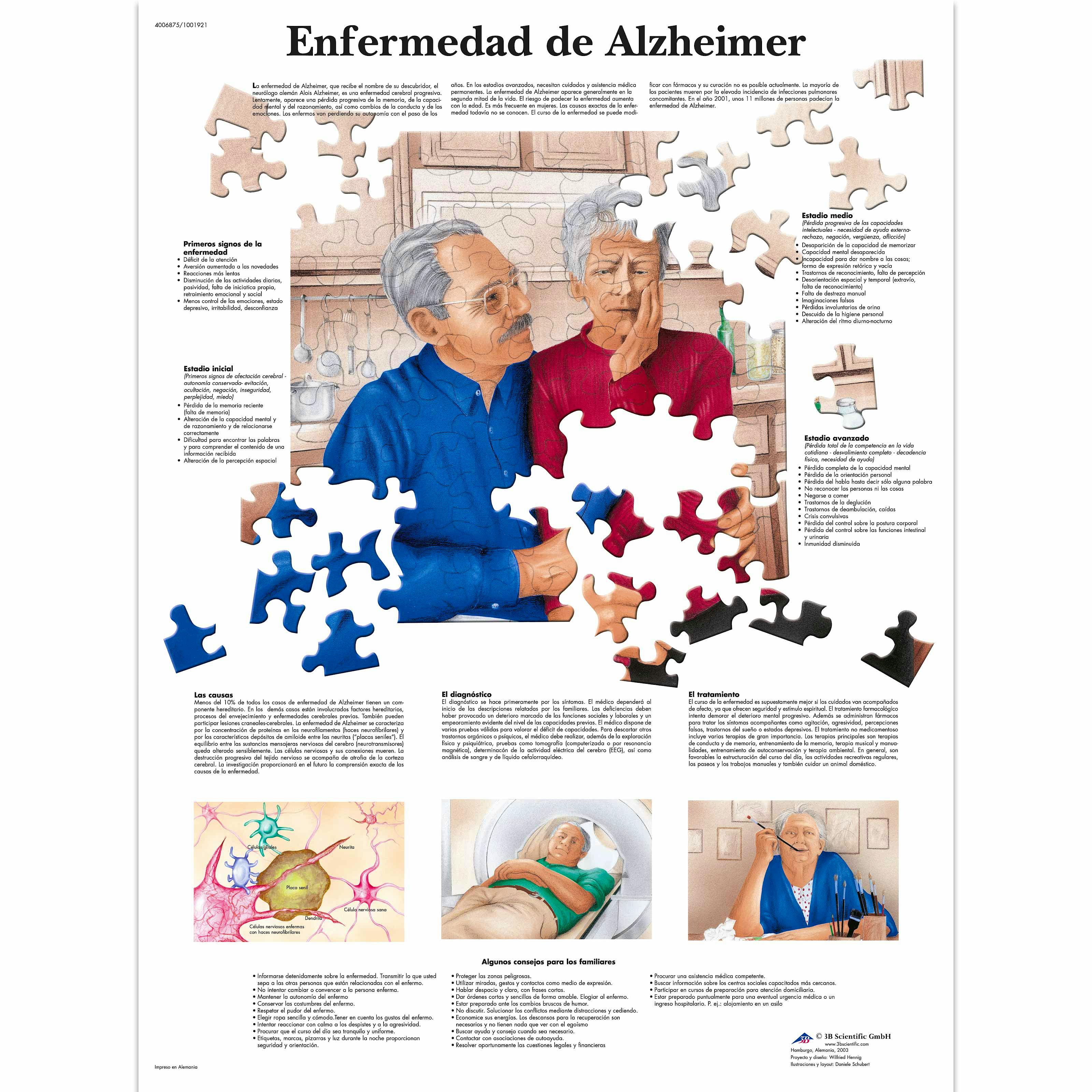 Lamina la Enfermedad de Alzheimer (formato 50 x 67 cm)