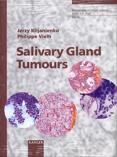Portada del libro 9783805570244 Salivary Gland Tumours