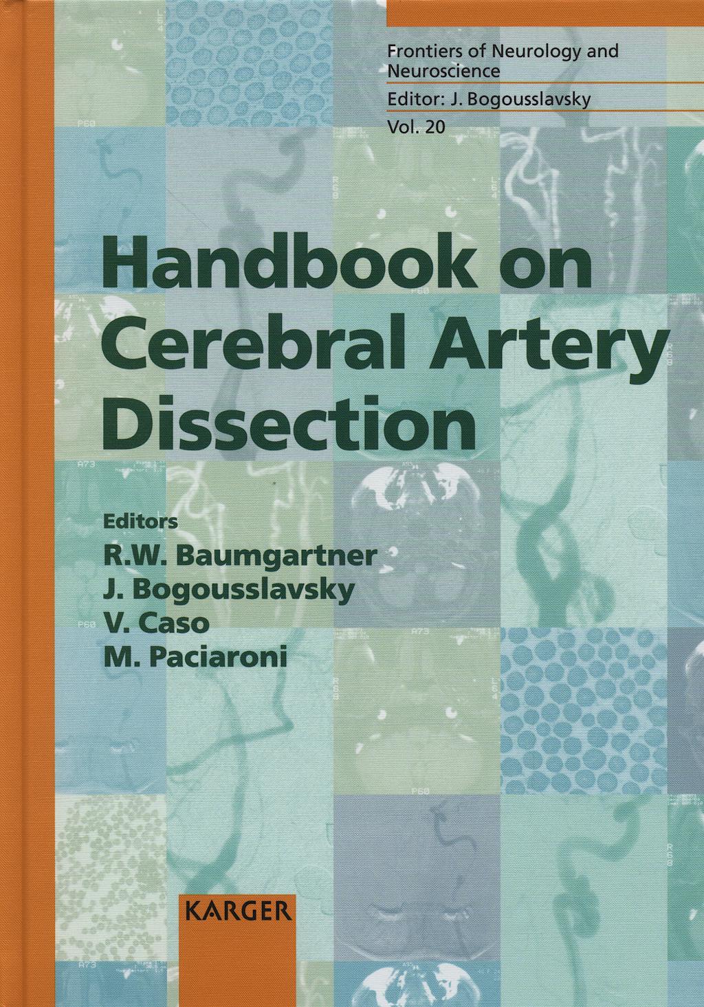 Portada del libro 9783805579865 Handbook on Cerebral Artery Dissection