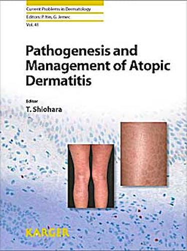 Portada del libro 9783805596862 Pathogenesis and Management of Atopic Dermatitis (Current Problems in Dermatology, Vol. 41)