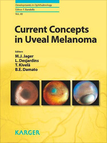 Portada del libro 9783805597906 Current Concepts in Uveal Melanoma