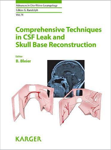 Portada del libro 9783805599528 Comprehensive Techniques in Csf Leak and Skull Base Reconstruction (Advances in Oto-Rhino-Laryngology, Vol. 74)