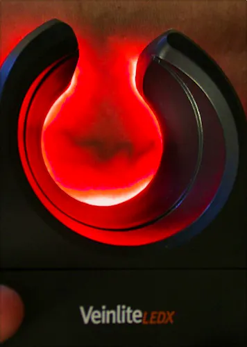 Veinlite Ledx Transiluminador Diseñado para Escleroterapia y Flebotomia