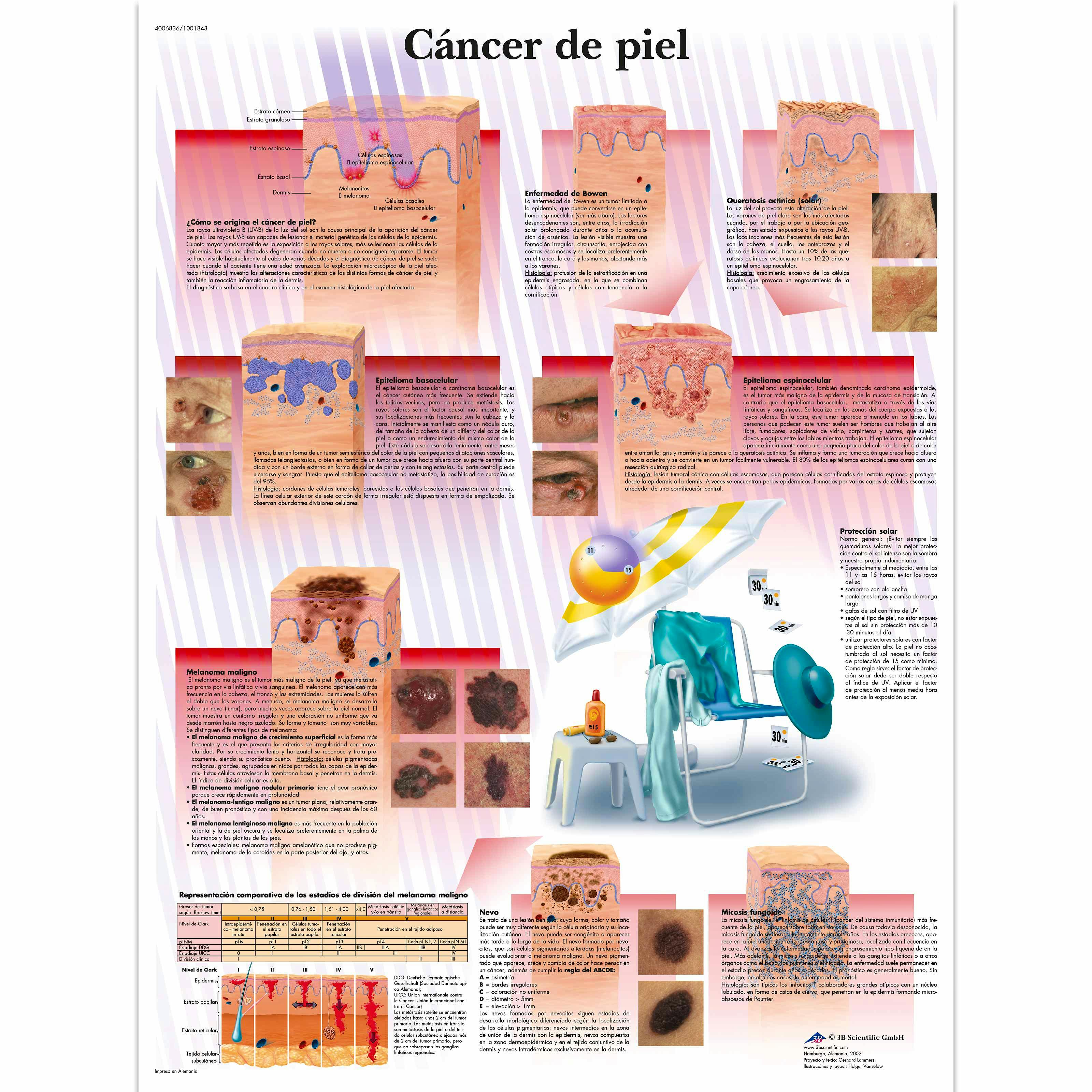 Lamina Cancer de Piel (formato 50 x 67 cm)