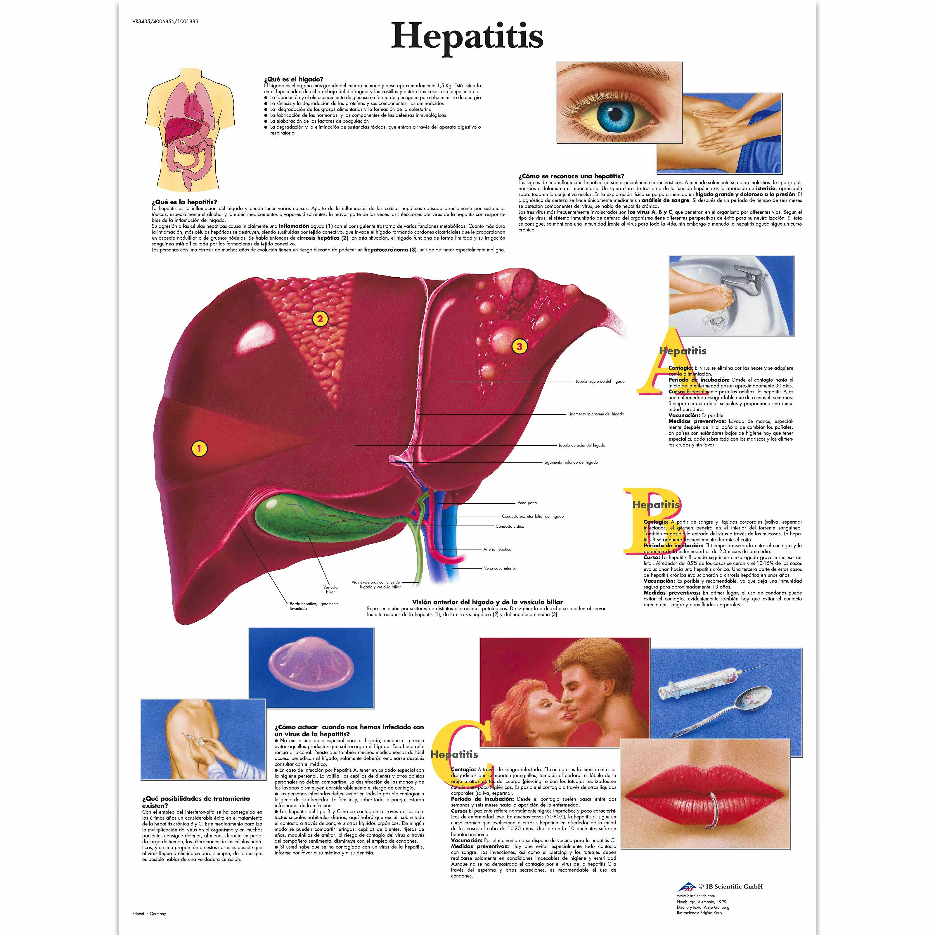 Lamina Hepatitis (formato 50 x 67 cm)