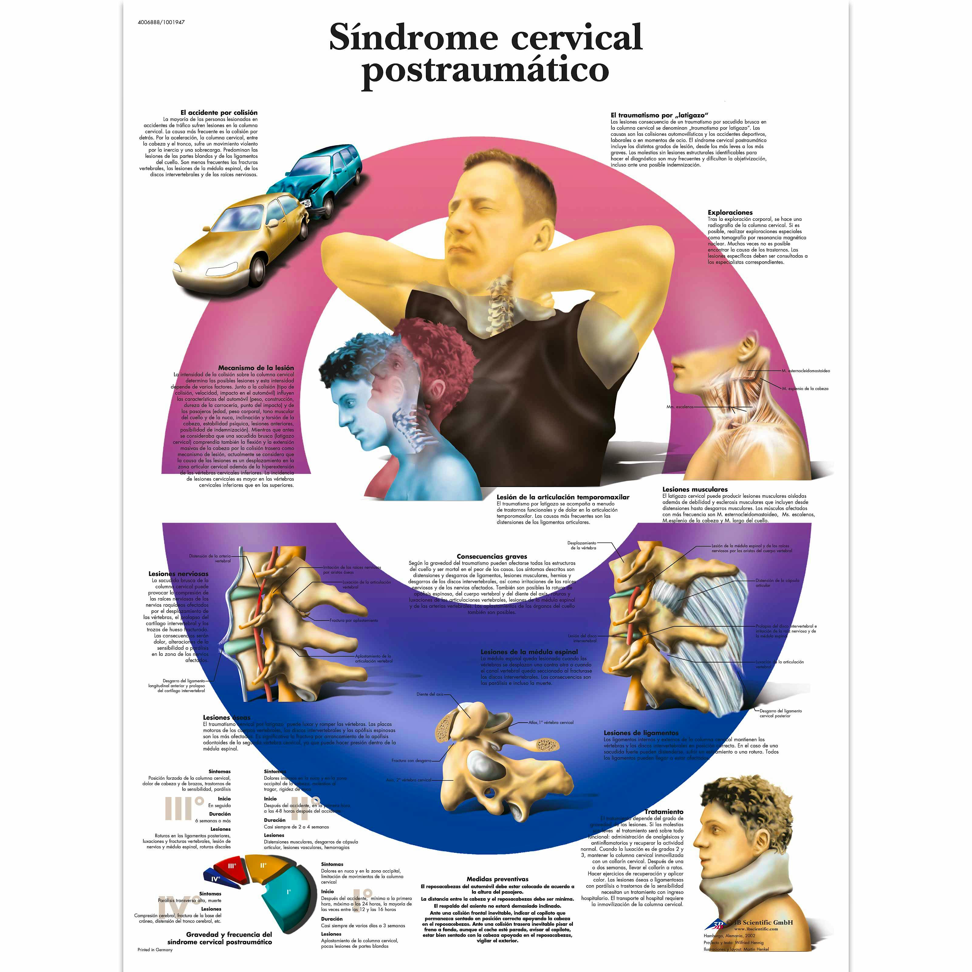 Lamina Sindrome Cervical Postraumatico (formato 50 x 67 cm)