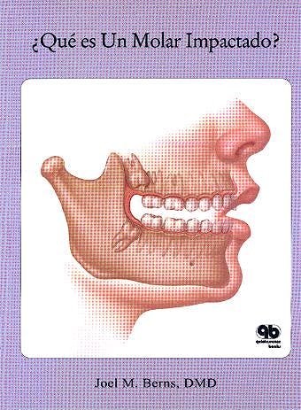 Portada del libro 9783833466151 ¿Que es un Molar Impactado?