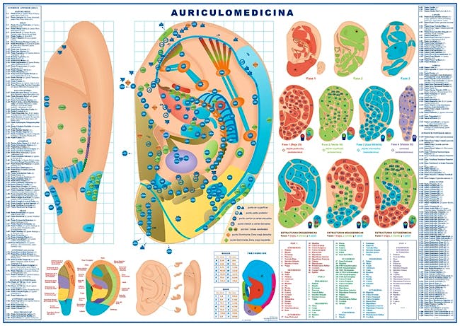 Lámina Auriculomedicina, 50 X 70 cm., Plastificada Brillo