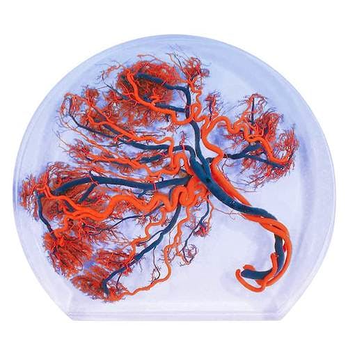 Placenta