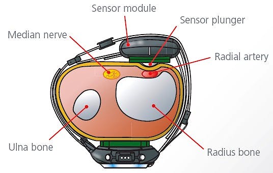 Reloj para la Medición de la Tensión Arterial Ambulatoria 24hs. por Tonometría Modelo Bpro