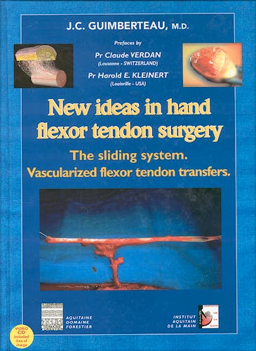 Portada del libro 9783854917793 New Ideas in Hand Flexor Tendon Surgery: Sliding System