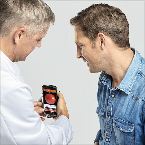 Funduscopio Heine IC2 Set/5 para Captura de Imágenes del Fondo del Ojo, C/carcasa-Adaptador para Iphone 5/5s