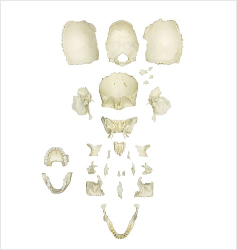 Cráneo de Estudio Médico Humano Desarticulado