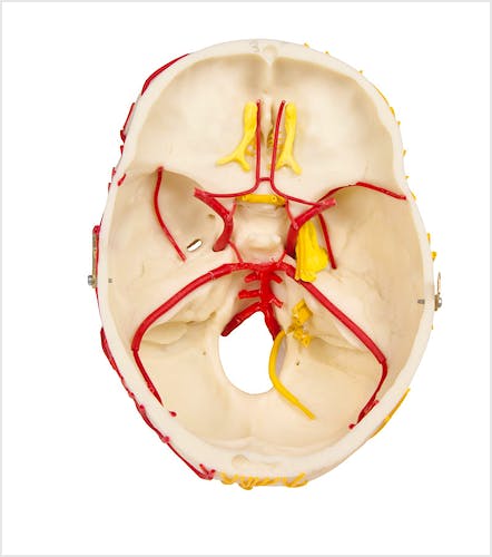 Cráneo Neurovascular con Cerebro