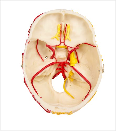Cráneo Neurovascular con Cerebro