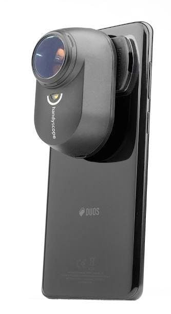 Dermatoscopio Handyscope Para Smarthphone y Tablets