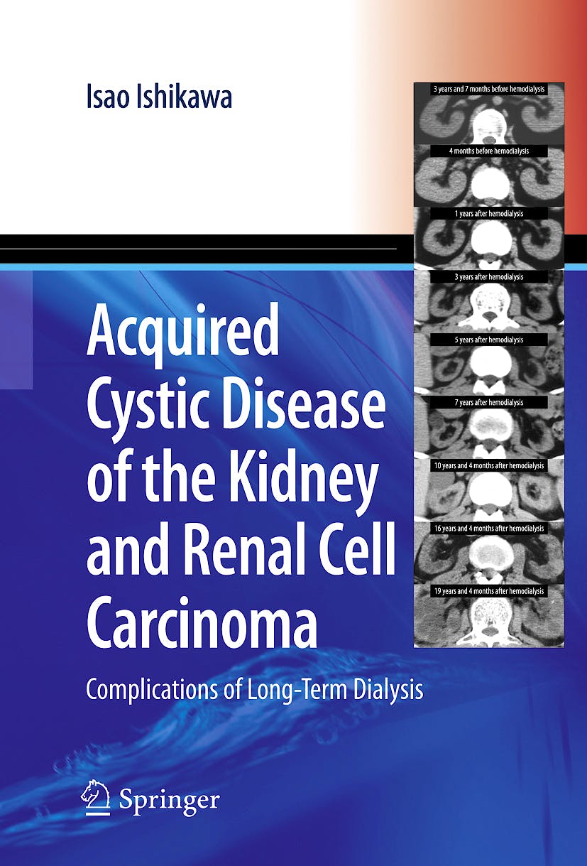 Portada del libro 9784431694793 Acquired Cystic Disease of the Kidney and Renal Cell Carcinoma