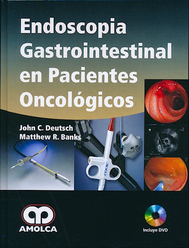 Portada del libro 9784582764611 Endoscopia Gastrointestinal en Pacientes Oncológicos