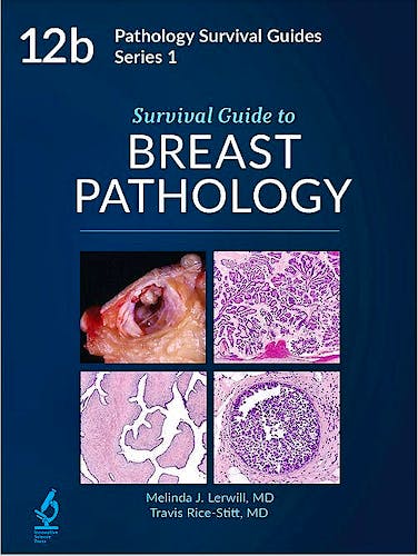 Portada del libro 9784773063950 Survival Atlas to Breast Pathology (Pathology Survival Guides Series 1, Vol. 12b)