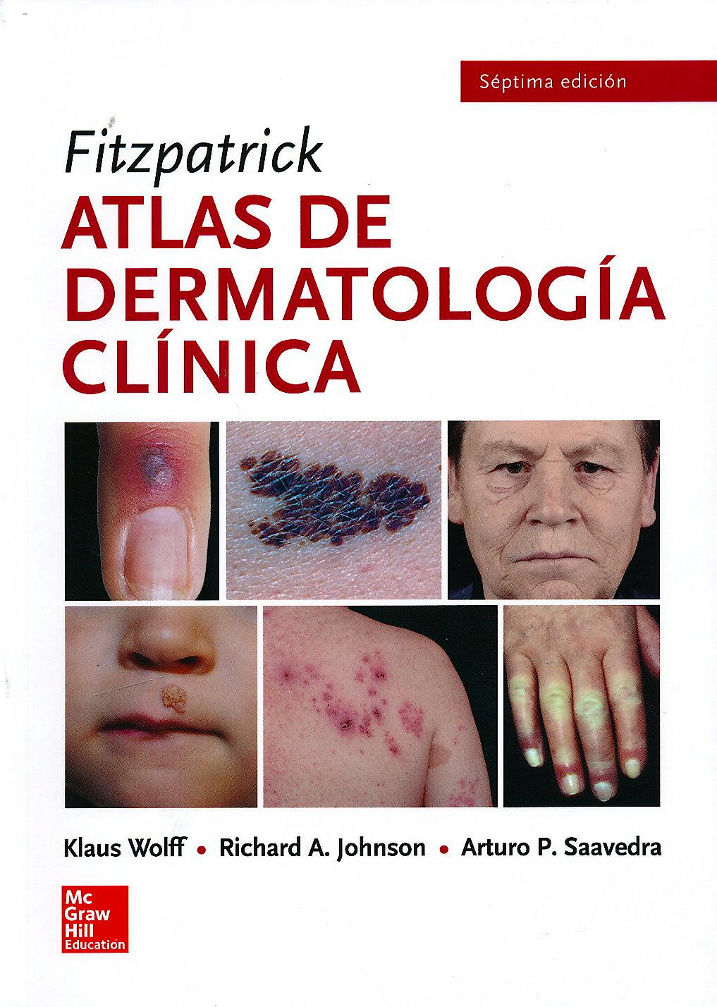 Portada del libro 9786071512048 Fitzpatrick Atlas de Dermatología Clínica