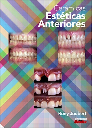 Portada del libro 9786079685720 Cerámicas Estéticas Anteriores