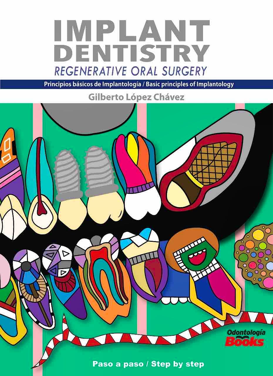 Portada del libro 9786079833626 Implant Dentistry / Principios Básicos de Implantología