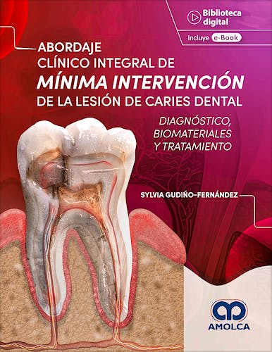 Portada del libro 9786287528444 Abordaje Clínico Integral de Mínima Intervención de la Lesión de Caries Dental. Diagnóstico, Biomateriales y Tratamiento