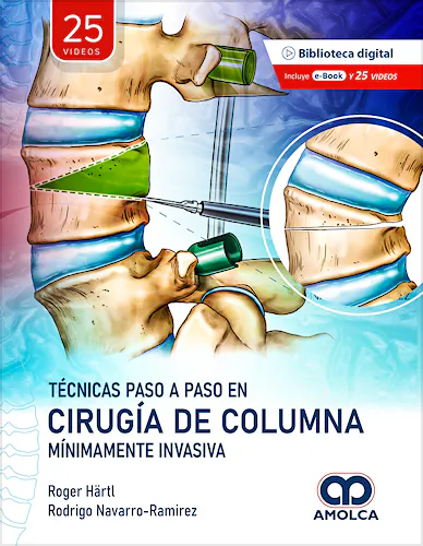 Portada del libro 9786287528727 Técnicas Paso a Paso en Cirugía de Columna Mínimamente Invasiva
