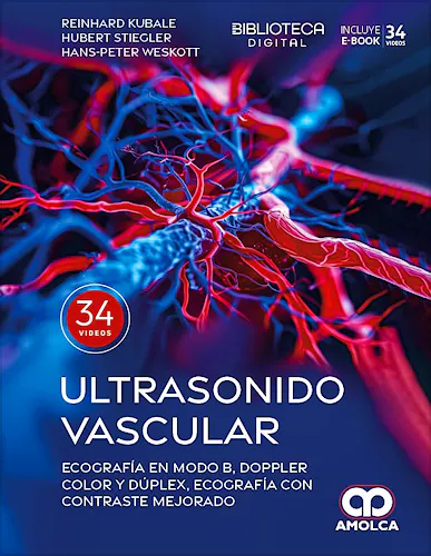 Portada del libro 9786287681682 Ultrasonido Vascular. Ecografía en Modo B, Doppler Color y Dúplex, Ecografía con Contraste Mejorado