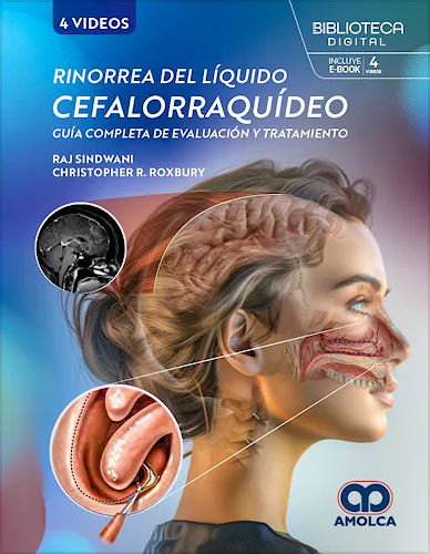 Portada del libro 9786287681729 Rinorrea del Líquido Cefalorraquídeo. Guía Completa de Evaluación y Tratamiento
