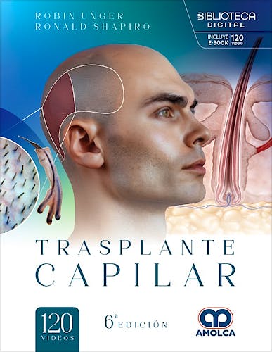 Portada del libro 9786287681774 Trasplante Capilar