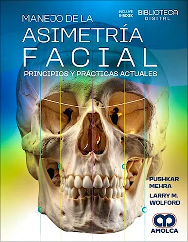 Portada del libro 9786287785175 Manejo de la Asimetría Facial. Principios y Prácticas Actuales