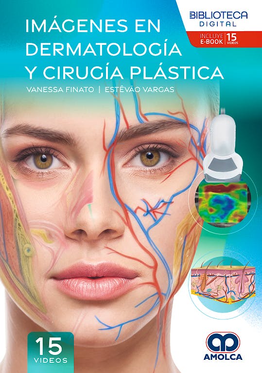 Portada del libro 9786287785311 Imágenes en Dermatología y Cirugía Plástica