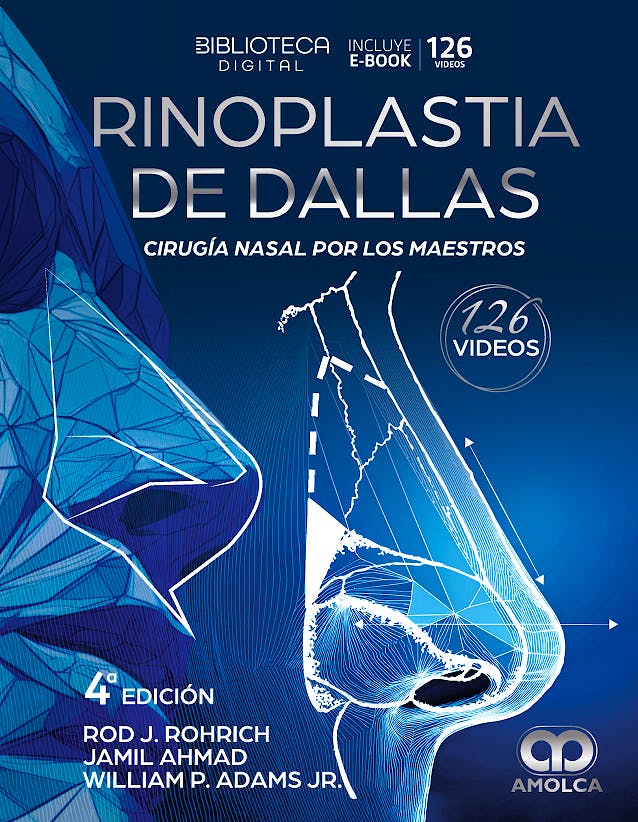 Portada del libro 9786287785434 Rinoplastia de DALLAS. Cirugía Nasal por los Maestros