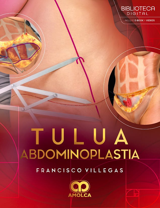 Portada del libro 9786287785496 TULUA Abdominoplastia