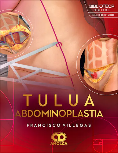 Portada del libro 9786287785496 TULUA Abdominoplastia