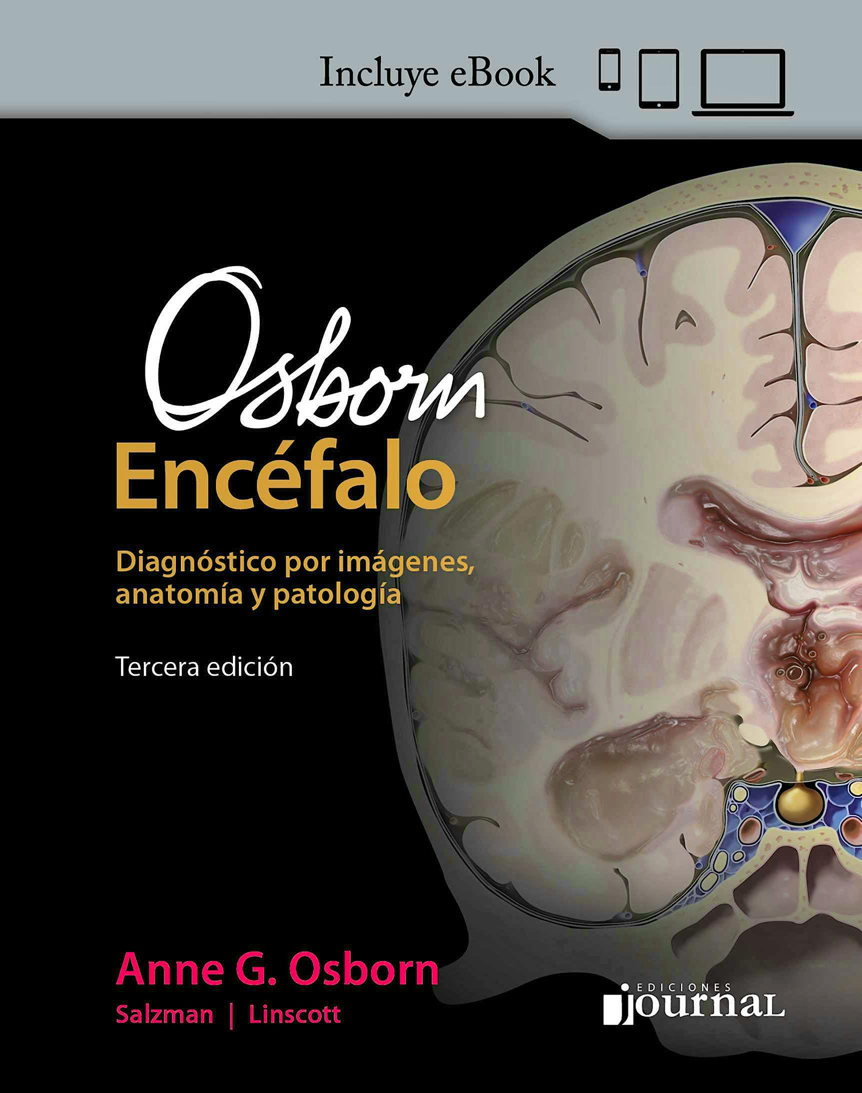 RHOTON Cranial Anatomy and Surgical Approaches