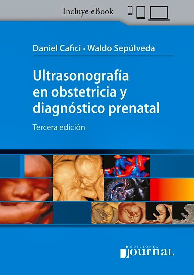 Portada del libro 9786319116878 Ultrasonografía en Obstetricia y Diagnóstico Prenatal
