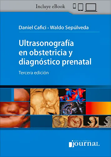 Portada del libro 9786319116878 Ultrasonografía en Obstetricia y Diagnóstico Prenatal