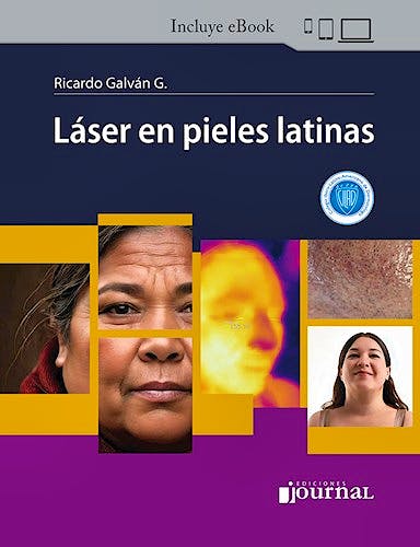 Portada del libro 9786319116885 Láser en Pieles Latinas