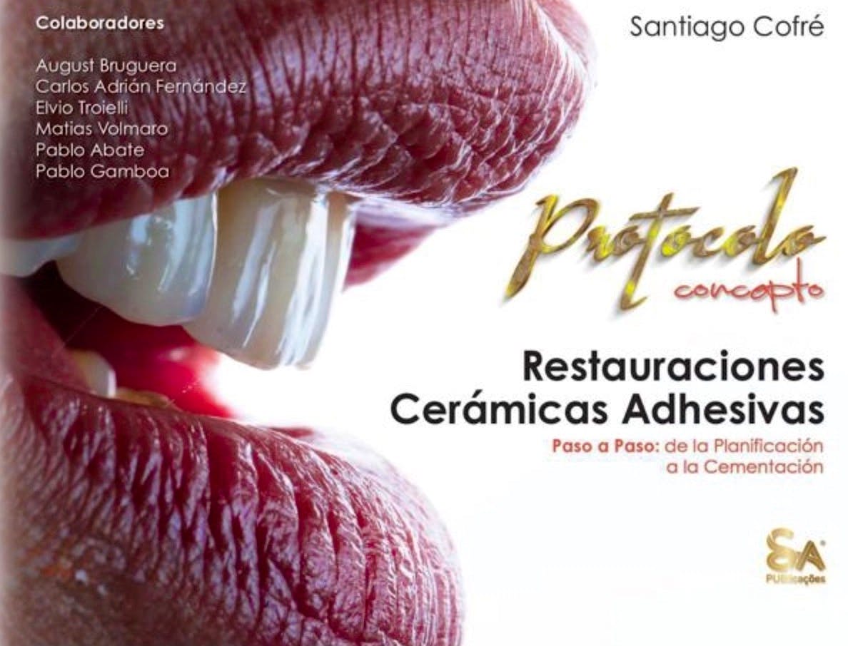 Portada del libro 9786586699241 Protocolo Concepto. Restauraciones Cerámicas Adhesivas Paso a Paso. De la Planificación a la Cementación
