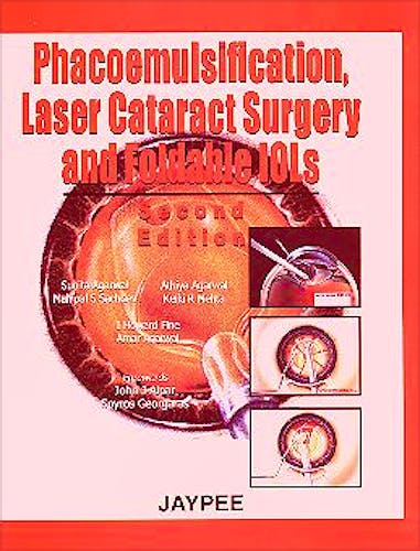 Portada del libro 9788171797608 Phacoemulsification Laser Cataract Surgery and Foldable Iols